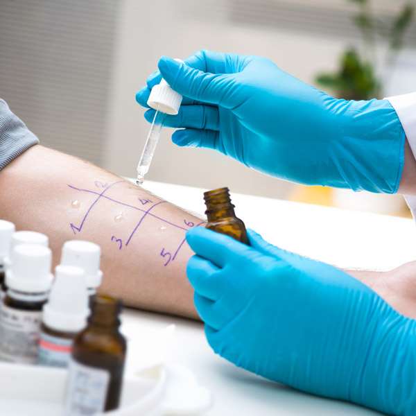 allergy skin test